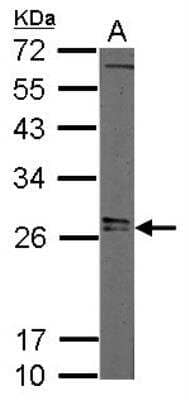 Western Blot: LIN-28A Antibody [NBP2-19355]