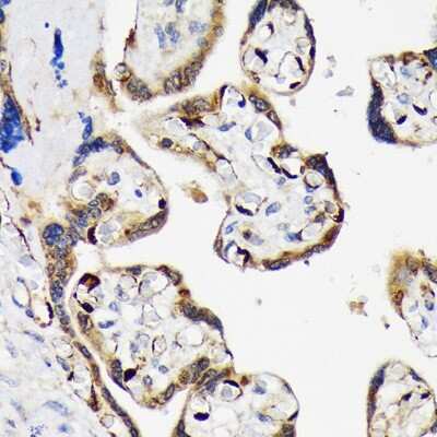 Immunohistochemistry-Paraffin: LIN-28B Antibody (7D7F7) [NBP3-16815]