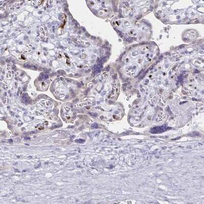 Immunohistochemistry-Paraffin: LIN-28B Antibody [NBP1-85438]