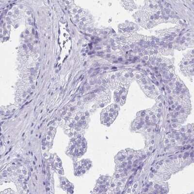 Immunohistochemistry-Paraffin: LIN-28B Antibody [NBP1-85438]