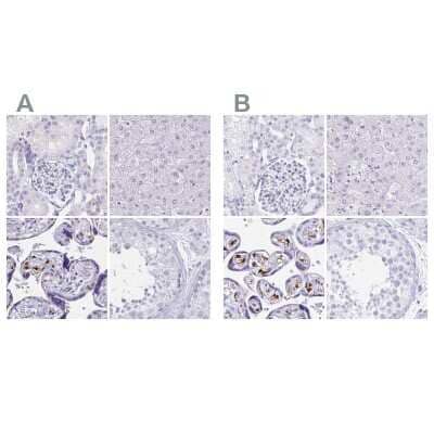 Immunohistochemistry-Paraffin: LIN-28B Antibody [NBP1-85438]