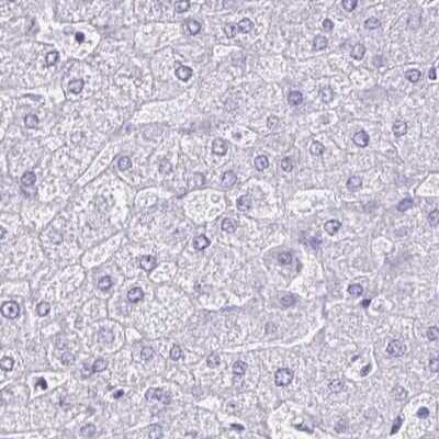 Immunohistochemistry-Paraffin: LIN-28B Antibody [NBP1-85438]