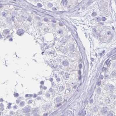 Immunohistochemistry-Paraffin: LIN-28B Antibody [NBP1-85438]