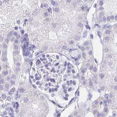 Immunohistochemistry-Paraffin: LIN-28B Antibody [NBP1-85438]