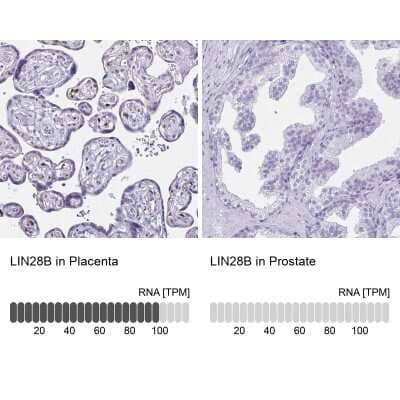 Immunohistochemistry-Paraffin: LIN-28B Antibody [NBP1-85438]