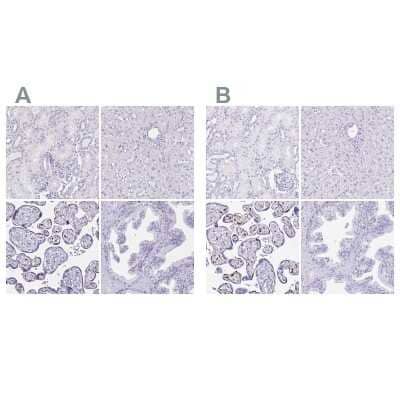 Immunohistochemistry-Paraffin: LIN-28B Antibody [NBP1-85438]