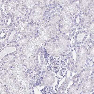 Immunohistochemistry-Paraffin: LIN-28B Antibody [NBP1-85438]