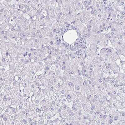 Immunohistochemistry-Paraffin: LIN-28B Antibody [NBP1-85438]