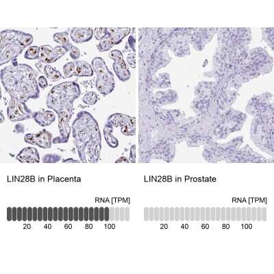 Immunohistochemistry-Paraffin: LIN-28B Antibody [NBP2-32352]