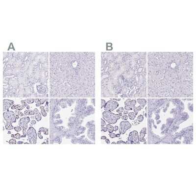 Immunohistochemistry-Paraffin: LIN-28B Antibody [NBP2-32352]