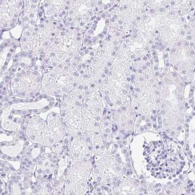 Immunohistochemistry-Paraffin: LIN-28B Antibody [NBP2-32352]