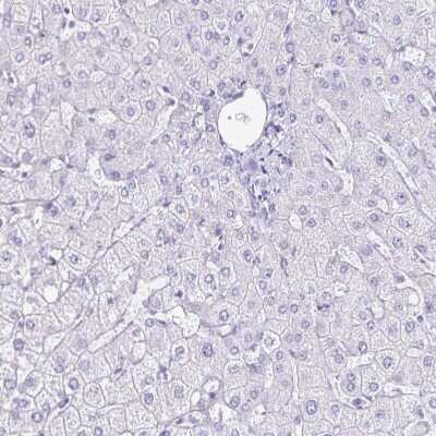 Immunohistochemistry-Paraffin: LIN-28B Antibody [NBP2-32352]