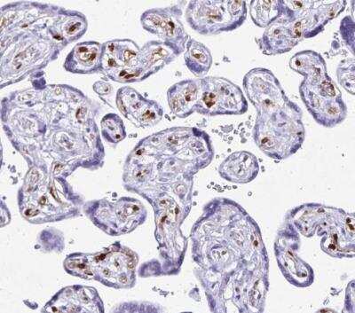 Immunohistochemistry-Paraffin: LIN-28B Antibody [NBP2-32352]