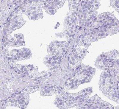 Immunohistochemistry-Paraffin: LIN-28B Antibody [NBP2-32352]