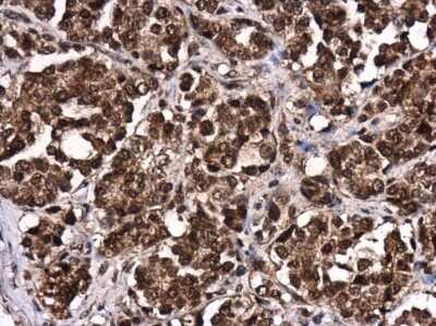 Immunohistochemistry-Paraffin: LIN-28B Antibody [NBP3-13029]