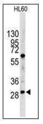 Western Blot: LIN-28B Antibody [NBP1-50529]