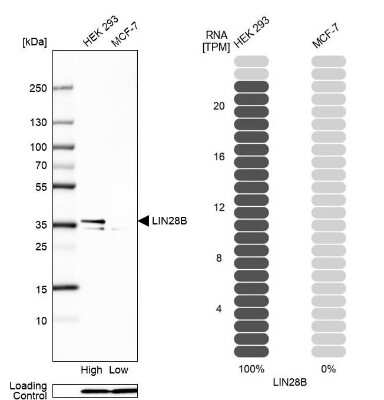 Western Blot: LIN-28B Antibody [NBP2-32352]