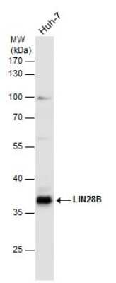 Western Blot: LIN-28B Antibody [NBP3-13029]