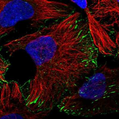 Immunocytochemistry/ Immunofluorescence: LIN-41/TRIM71 Antibody [NBP1-81306]