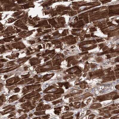 Immunohistochemistry-Paraffin: LIN-41/TRIM71 Antibody [NBP1-81306]