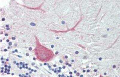 Immunohistochemistry-Paraffin: LIN-41/TRIM71 Antibody [NBP2-27490]
