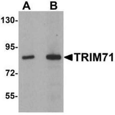 Western Blot: LIN-41/TRIM71 AntibodyBSA Free [NBP1-76281]