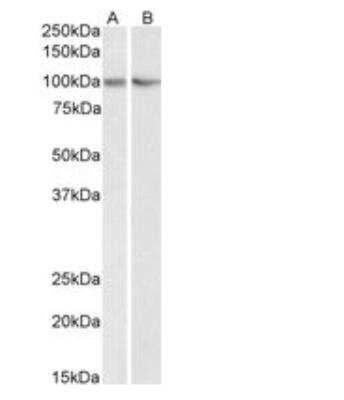 Western Blot: LIN-41/TRIM71 Antibody [NBP2-27490]