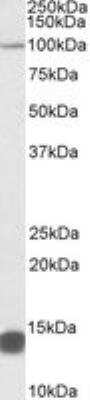 Western Blot: LIN-41/TRIM71 Antibody [NBP2-27491]