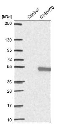 Western Blot: LIN10 Antibody [NBP1-88453]