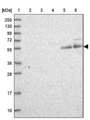 Western Blot: LIN10 Antibody [NBP1-88454]