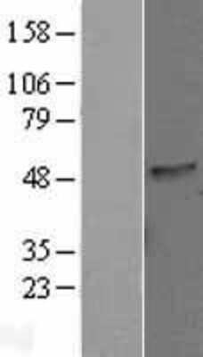 Western Blot: LIN10 Overexpression Lysate [NBL1-08225]