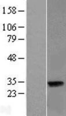 Western Blot: LIN37 Overexpression Lysate [NBL1-12542]