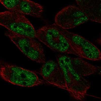 Immunocytochemistry/ Immunofluorescence: LIN52 Antibody [NBP2-55623]