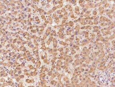 Immunohistochemistry-Paraffin: LIN52 Antibody [NBP3-06592]