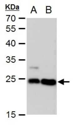 Western Blot: LIN7 Antibody (377) [NBP2-43587]