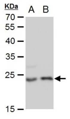 Western Blot: LIN7 Antibody (879) [NBP2-43695]