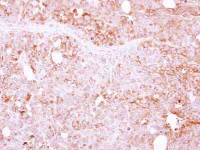 Immunohistochemistry-Paraffin: LIN7 Antibody [NBP2-15016]