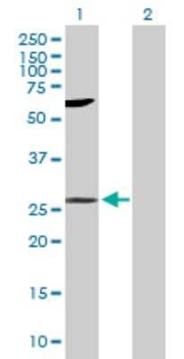 Western Blot: LIN7 Antibody [H00008825-B01P]