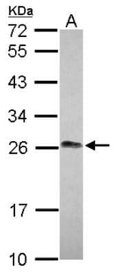 Western Blot: LIN7 Antibody [NBP2-15016]