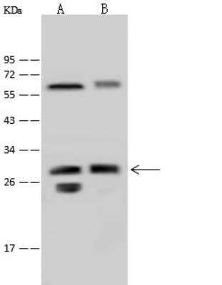 Western Blot: LIN7 Antibody [NBP2-99481]