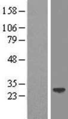 Western Blot: LIN7 Overexpression Lysate [NBP2-10532]