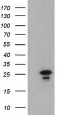 Western Blot: LIN7B Antibody (OTI1C9) [NBP2-02852]