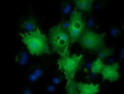 Immunocytochemistry/ Immunofluorescence: LIN7B Antibody (OTI1C9) - Azide and BSA Free [NBP2-72131]