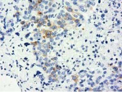 Immunohistochemistry: LIN7B Antibody (OTI1C9) - Azide and BSA Free [NBP2-72131]