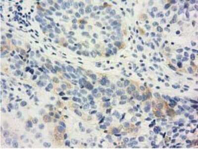 Immunohistochemistry: LIN7B Antibody (OTI1C9) - Azide and BSA Free [NBP2-72131]