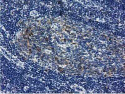 Immunohistochemistry: LIN7B Antibody (OTI1C9) - Azide and BSA Free [NBP2-72131]