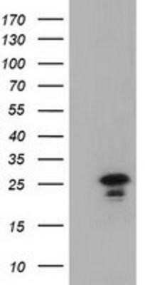 Western Blot: LIN7B Antibody (OTI1C9)Azide and BSA Free [NBP2-72131]