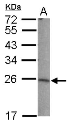 Western Blot: LIN7B Antibody [NBP2-19358]