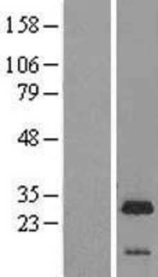 Western Blot: LIN7B Overexpression Lysate [NBL1-12544]