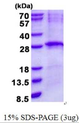 SDS-PAGE: Recombinant Human LIN7B His Protein [NBP2-23198]